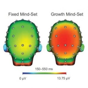 growth-mindset-brain-scan-square-450x449